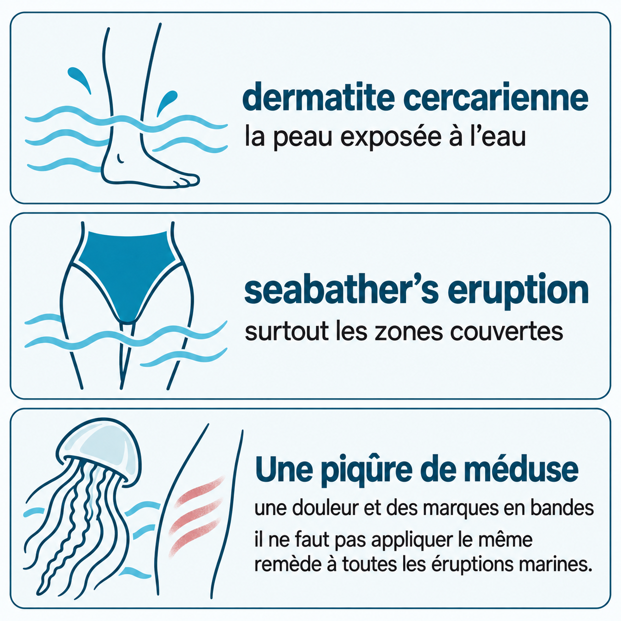 Schéma illustratif : dermatite cercarienne ; la peau exposée à l’eau ; seabather’s eruption ; surtout les zones couvertes ; Une piqûre de méduse ; une douleur et des marques en bandes ; il ne faut pas appliquer le même remède à toutes les éruptions marines.