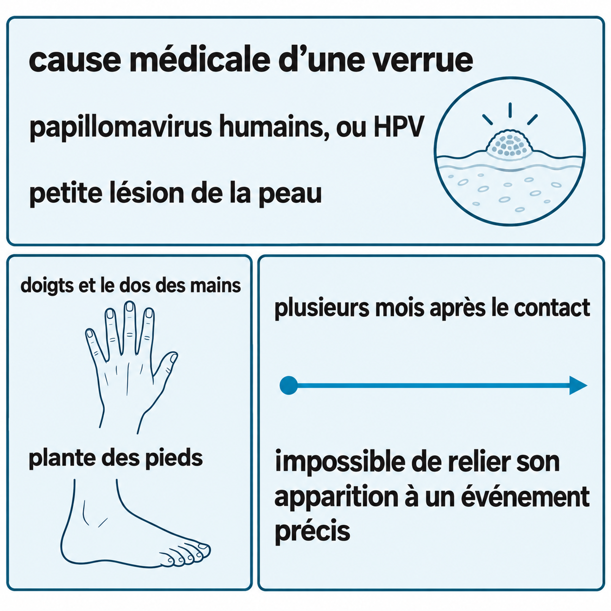 Schéma illustratif : cause médicale d’une verrue ; papillomavirus humains, ou HPV ; petite lésion de la peau ; doigts et le dos des mains ; plante des pieds ; plusieurs mois après le contact ; impossible de relier son apparition à un événement précis